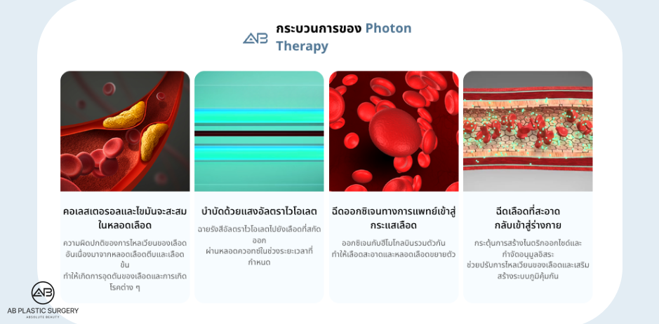 เทคโนโลยีสเต็มเซลล์และ Photon Therapy ของโรงพยาบาลศัลยกรรมAB เป็นเวชศาสตร์ฟื้นฟูที่โดดเด่นในการทำความสะอาดเลือดและเสริมการทำงานของหลอดเลือด