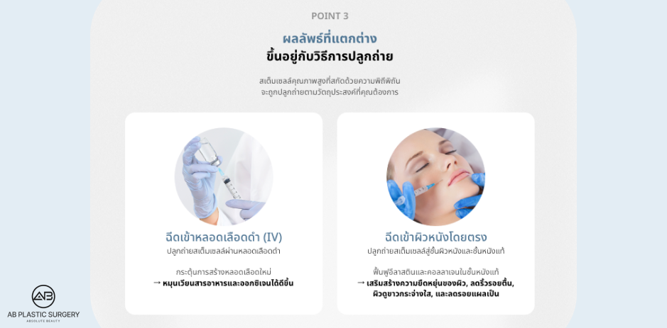 การเปรียบเทียบผลลัพธ์ของวิธีการปลูกถ่ายสเต็มเซลล์ของโรงพยาบาลศัลยกรรมAB ทั้งแบบฉีดเข้าหลอดเลือดดำและฉีดเข้าสู่ชั้นผิวหนังโดยตรง