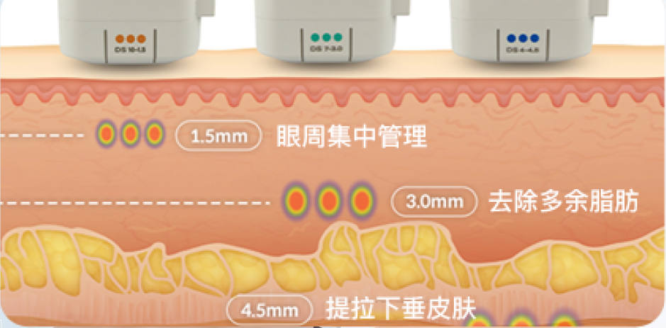 推薦韓國超聲波拉提醫美診所