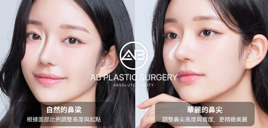 分別呈現自然鼻樑與精緻鼻尖，AB整形外科示意圖