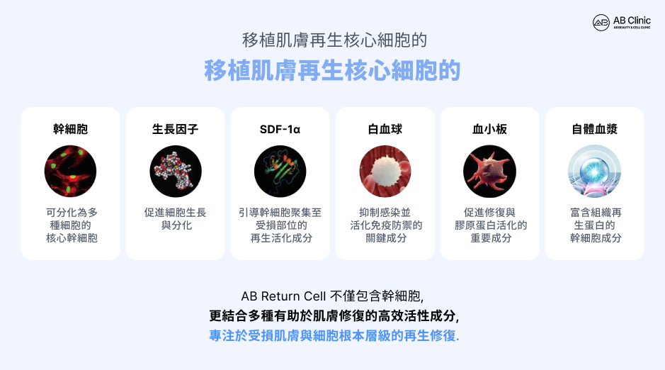 AB幹細胞水光針技術示意圖，說明結合幹細胞、成長因子、SDF-1α、白血球、血小板與自體血漿等成分，協同促進受損肌膚修復與細胞再生的作用機制