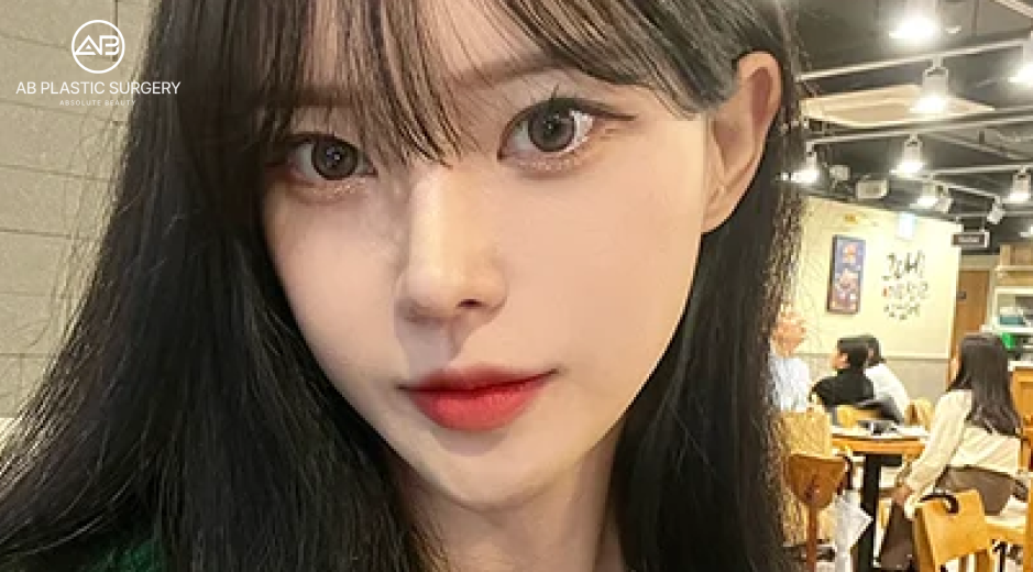 線雕透過刺激真皮層膠原增生實現V臉輪廓與年輕緊緻肌膚的效果