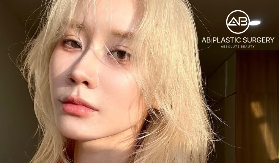 Ảnh Hương Witch sau 1 tháng phẫu thuật mắt